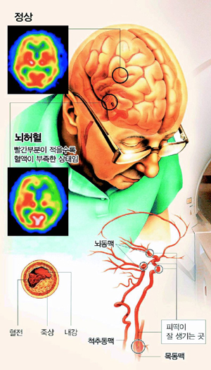 클릭하면 큰 이미지를 볼 수 있습니다.
